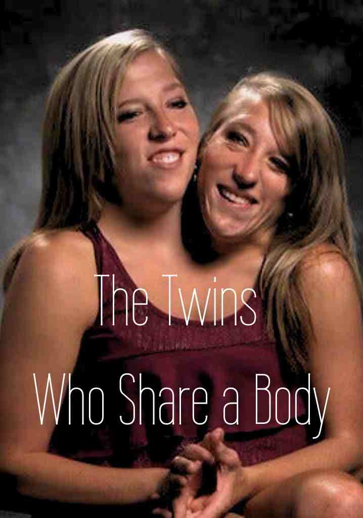 The Twins Who Share a Body (2007) | Full Documentary