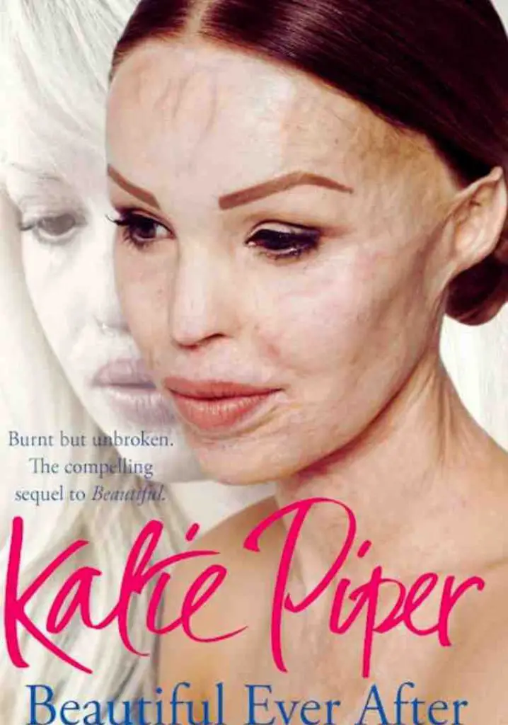 Katie Piper: My Beautiful Face (2009) | Full Documentary